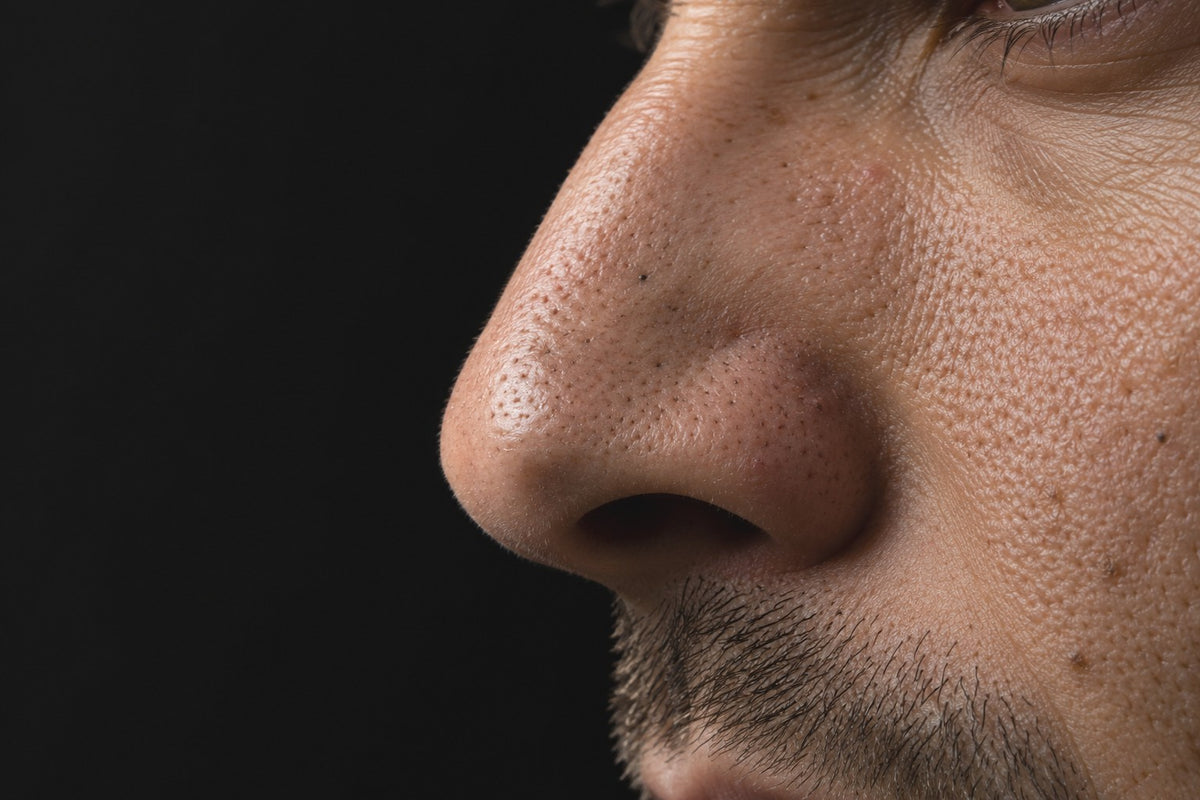 Close-up of a nose: sebaceous filaments and blackheads