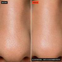 Illustration: what smoother pore texture looks like by week 8. Not a customer photo.