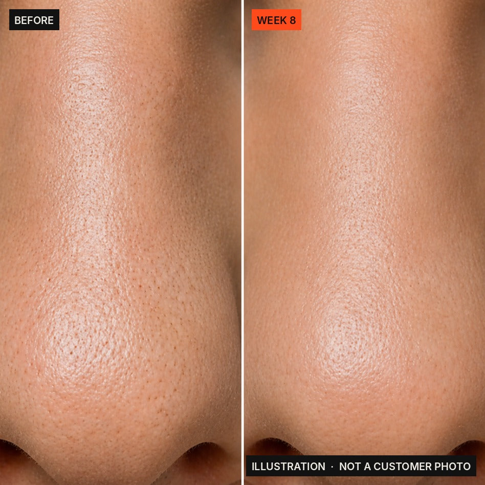 Illustration: what smoother pore texture looks like by week 8. Not a customer photo.
