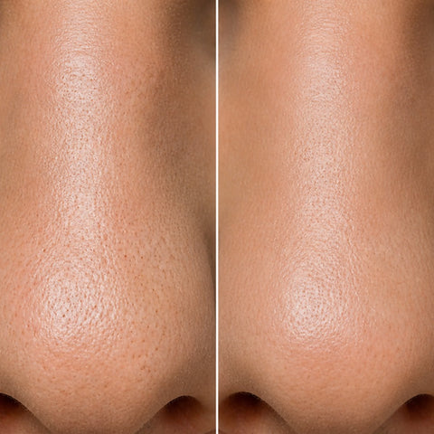 Illustration of nose pore texture, before and at week 8. Not a customer photo.